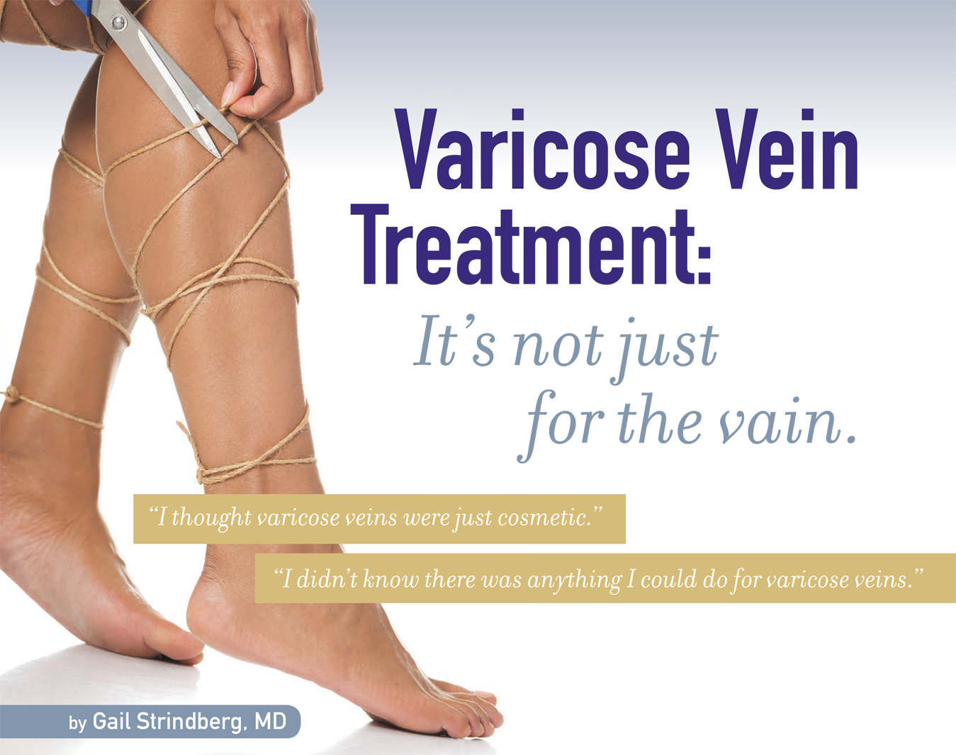 What is the best treatment for varicose veins
