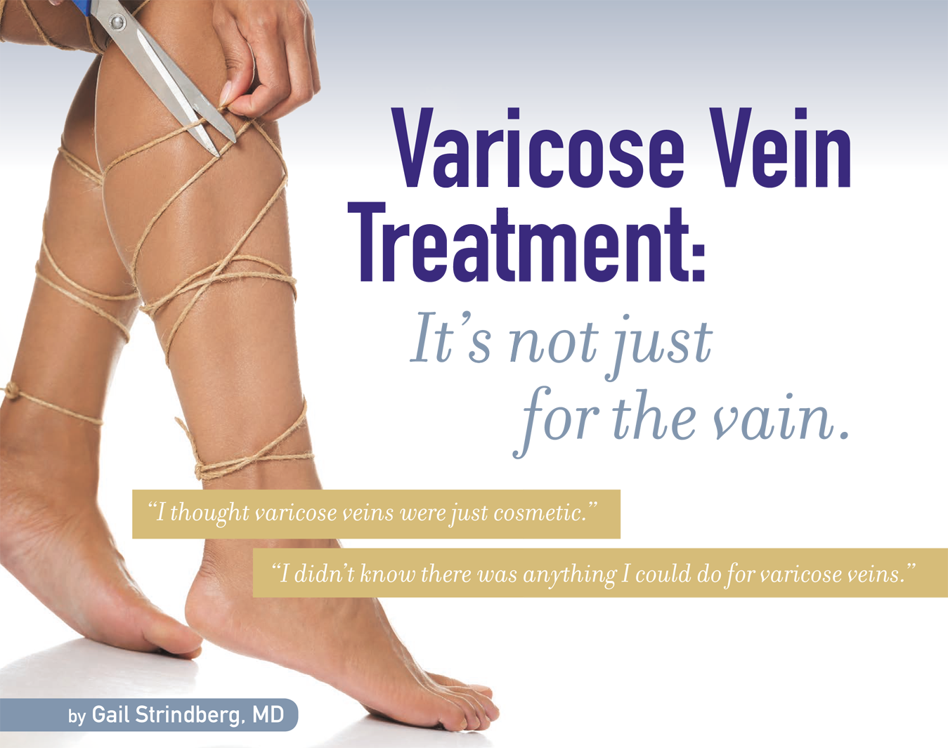 how-to-recognize-varicose-veins-vein-specialists-of-the-carolinas