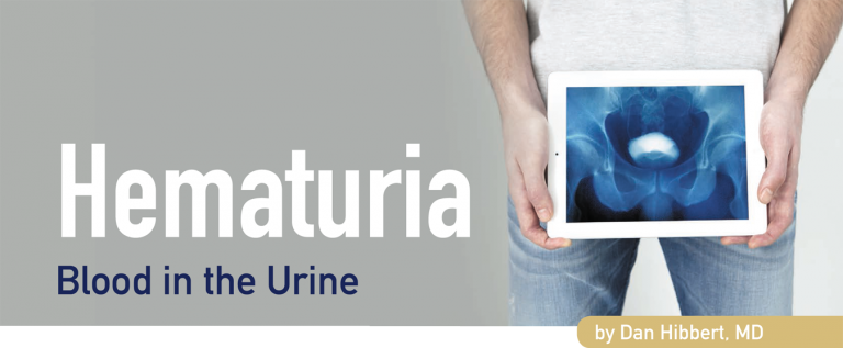 Hematuria Northpointe Medical 