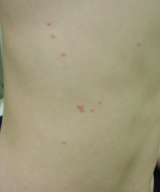 Pediatric Skin Conditions | Northpointe Medical